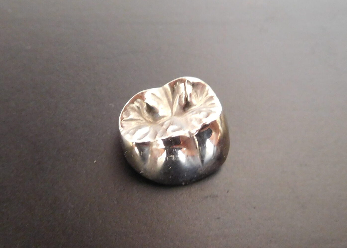 金銀パラジウム合金(銀歯)