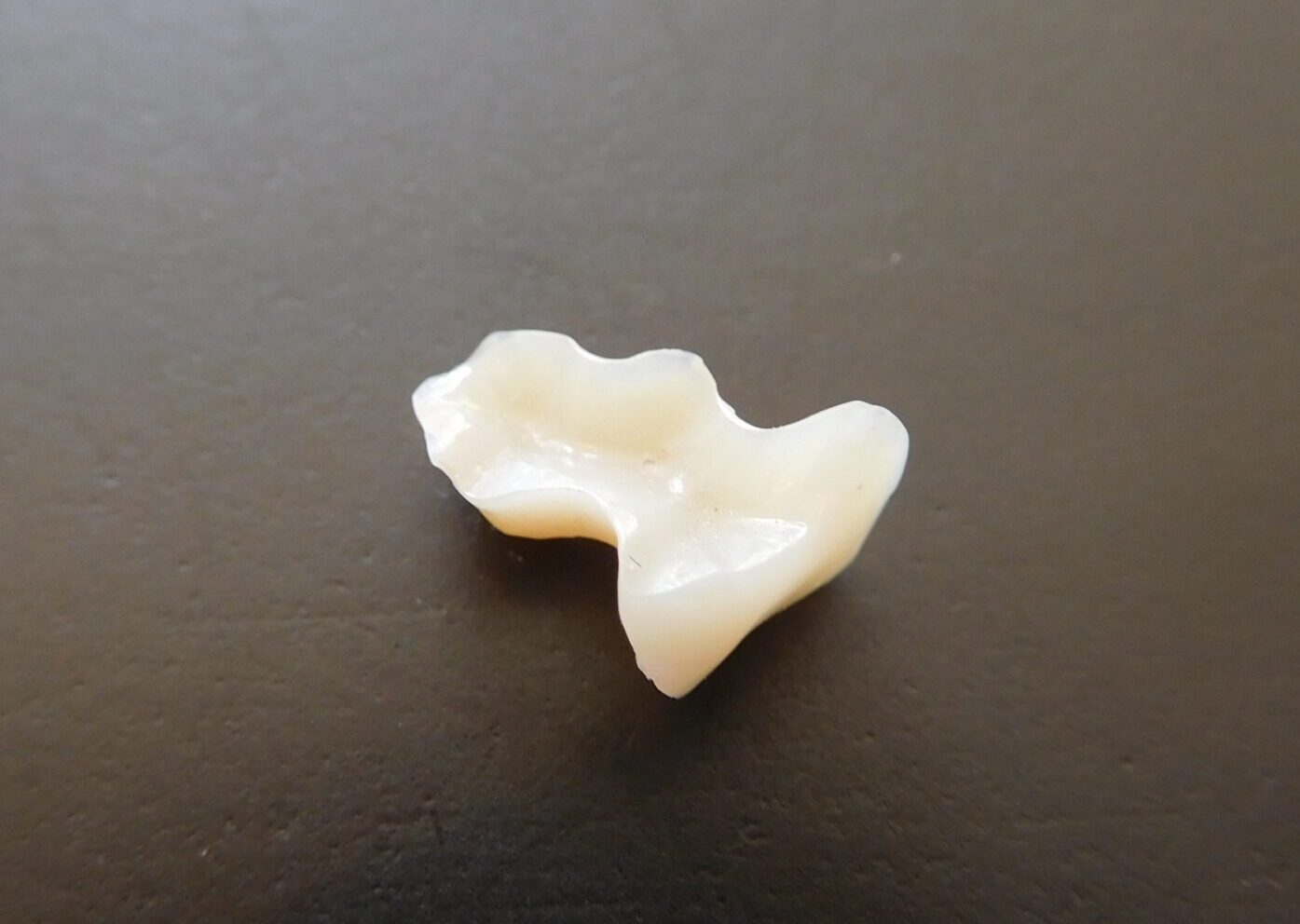 e-max(オールセラミックス)